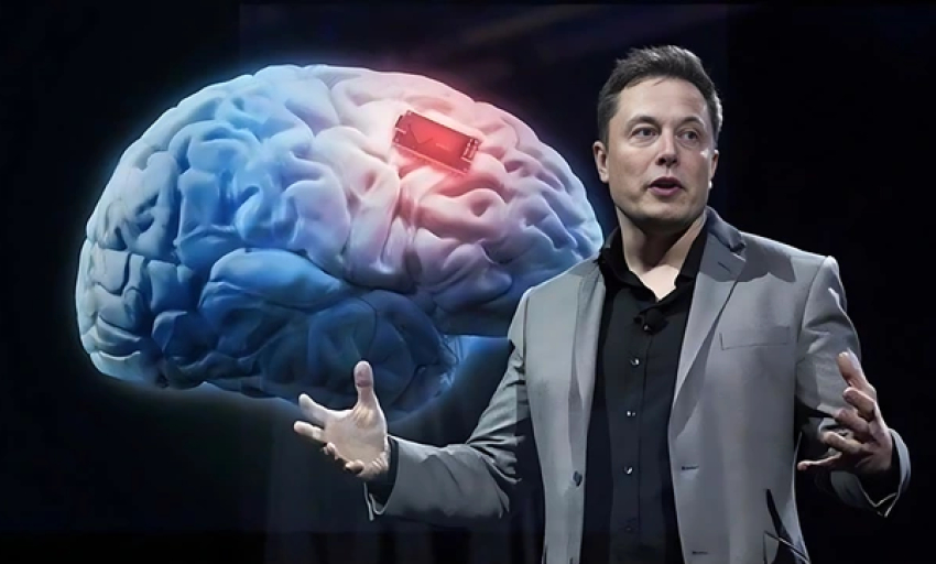Tự chỉnh video, kể chuyện bằng... chip não Neuralink