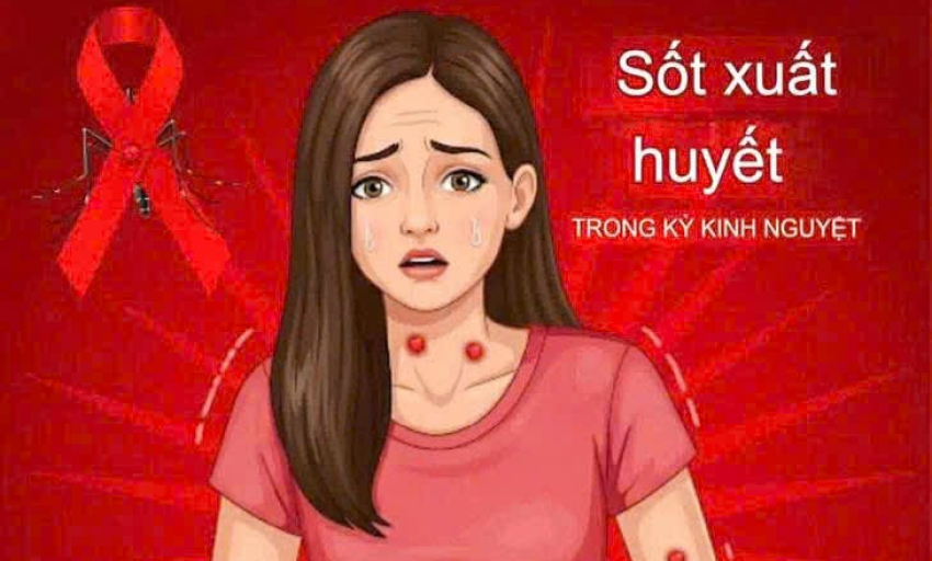 Cảnh giác sốt xuất huyết nhầm với chảy máu kinh nguyệt