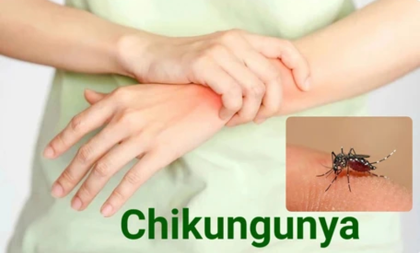 Bệnh Chikungunya đang diễn biến phức tạp, ai cần cẩn trọng?