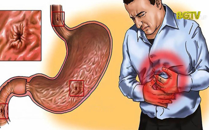 Cẩn trọng với bệnh xuất huyết tiêu hoá