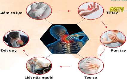 Phòng ngừa bệnh đau cổ vai gáy